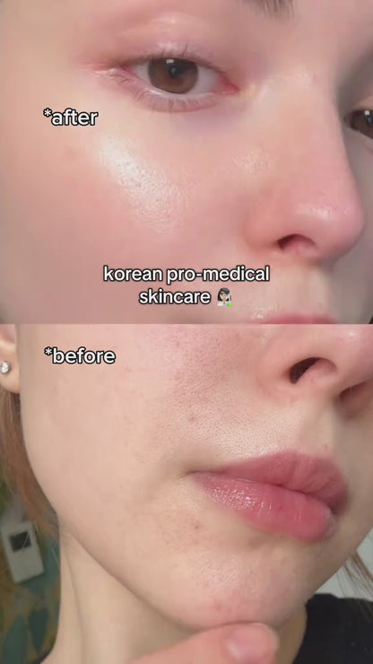 ECTO-PDRN 10% Extreme Dose